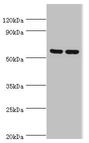PRKAG3 / AMPK Gamma 3 Antibody - Western blot All lanes: 5-AMP-activated protein kinase subunit gamma-3 antibody at 5µg/ml Lane 1: Hela whole cell lysate Lane 2: HepG2 whole cell lysate Secondary Goat polyclonal to rabbit IgG at 1/10000 dilution Predicted band size: 55, 52 kDa Observed band size: 55 kDa