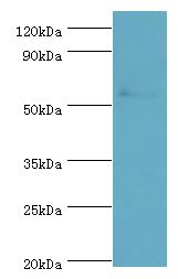 PRKAG3 / AMPK Gamma 3 Antibody - Western blot western blot. All lanes: Carbonic anhydrase 1 antibody at 6 ug/ml+rat brain tissue. Secondary antibody: Goat polyclonal to rabbit at 1:10000 dilution. Predicted band size: 54 kDa. Observed band size: 54 kDa.
