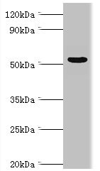 PRKAG3 / AMPK Gamma 3 Antibody - Western blot All lanes: Carbonic anhydrase 1 antibody at 6µg/ml + Rat brain tissue Secondary Goat polyclonal to rabbit IgG at 1/10000 dilution Predicted band size: 55, 52 kDa Observed band size: 55 kDa