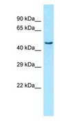 PRKAG3 / AMPK Gamma 3 Antibody - PRKAG3 / AMPK Gamma 3 antibody Western Blot of Fetal Heart.  This image was taken for the unconjugated form of this product. Other forms have not been tested.