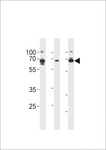 PRKAG3 / AMPK Gamma 3 Antibody - PRKAG3 Antibody western blot of HeLa,HepG2,RD cell line lysates (35 ug/lane). The PRKAG3 antibody detected the PRKAG3 protein (arrow).