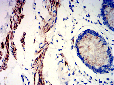 PRKAG3 / AMPK Gamma 3 Antibody - Immunohistochemical analysis of paraffin-embedded rectum tissues using PRKAG3 mouse mAb with DAB staining.