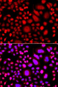 PRKAG3 / AMPK Gamma 3 Antibody - Immunofluorescence analysis of A549 cells using PRKAG3 Polyclonal Antibody.