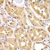 PRKAG3 / AMPK Gamma 3 Antibody - Immunohistochemistry of paraffin-embedded Human kidney using PRKAG3 Polyclonal Antibody at dilution of 1:100 (40x lens).