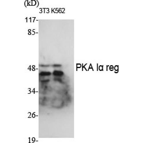 PRKAR1A Antibody - Western blot of PKA Ialpha reg antibody