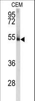 PRKAR1A Antibody - Western blot of anti-PKR1 Antibody in CEM cell line lysates (35 ug/lane). PKR1 (arrow) was detected using the purified antibody.