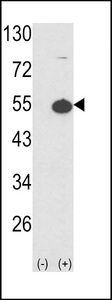 PRKAR1A Antibody - Western blot of PKR1 (arrow) using rabbit polyclonal hPKR1-M1. 293 cell lysates (2 ug/lane) either nontransfected (Lane 1) or transiently transfected with the PKR1 gene (Lane 2). (2 ug/ml)