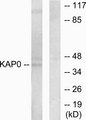PRKAR1A Antibody - Western blot analysis of lysates from HepG2 cells, using KAP0 Antibody. The lane on the right is blocked with the synthesized peptide.