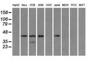 PRKAR1A Antibody - Western blot analysis of extracts (35ug) from 9 different cell lines by using anti-PRKAR1A monoclonal antibody.