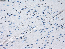 PRKAR1A Antibody - Immunohistochemical staining of paraffin-embedded colon tissue using anti-PRKAR1A mouse monoclonal antibody. (Dilution 1:50).