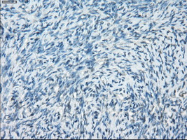 PRKAR1A Antibody - Immunohistochemical staining of paraffin-embedded Ovary tissue using anti-PRKAR1A mouse monoclonal antibody. (Dilution 1:50).