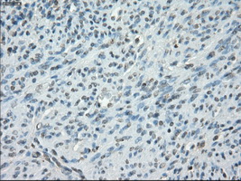 PRKAR1A Antibody - Immunohistochemical staining of paraffin-embedded endometrium tissue using anti-PRKAR1A mouse monoclonal antibody. (Dilution 1:50).