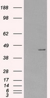 PRKAR1A Antibody - HEK293T cells were transfected with the pCMV6-ENTRY control (Left lane) or pCMV6-ENTRY PRKAR1A (Right lane) cDNA for 48 hrs and lysed. Equivalent amounts of cell lysates (5 ug per lane) were separated by SDS-PAGE and immunoblotted with anti-PRKAR1A.
