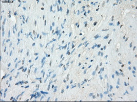 PRKAR1A Antibody - Immunohistochemical staining of paraffin-embedded prostate tissue using anti-PRKAR1A mouse monoclonal antibody. (Dilution 1:50).