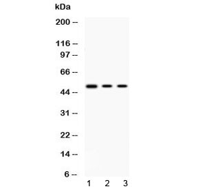 PRKAR1A Antibody - Western blot testing of 1) rat thymus, 2) human HepG2 and 3) human MCF7 lysate with PRKAR1A antibody at 0.5ug/ml. Predicted molecular weight ~48 kDa.