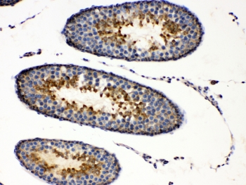 PRKAR1A Antibody - IHC testing of FFPE rat testis tissue with PRKAR1A antibody at 1ug/ml. Required HIER: steam section in pH6 citrate buffer for 20 min and allow to cool prior to testing.