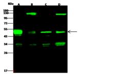 PRKAR1A Antibody - Anti-PRKAR1A rabbit polyclonal antibody at 1:500 dilution. Lane A: HepG Whole Cell Lysate. Lane B: HeLa Whole Cell Lysate. Lane C: A549 Whole Cell Lysate. Lane D: Jurkat Whole Cell Lysate. Lysates/proteins at 30 ug per lane. Secondary: Goat Anti-Rabbit IgG H&L (Dylight 800) at 1/10000 dilution. Developed using the Odyssey technique. Performed under reducing conditions. Predicted band size: 43 kDa. Observed band size: 49 kDa. (We are unsure as to the identity of these extra bands.)