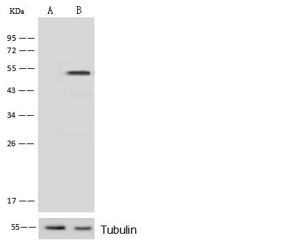 PRKAR1A Antibody - Anti-PRKAR1A rabbit polyclonal antibody at 1:500 dilution. Lane A: PRKAR1A konckout Hela Whole Cell Lysate. Lane B: Hela Whole Cell Lysate. Lysates/proteins at 10 ug per lane. Secondary: Goat Anti-Rabbit IgG (H+L)/HRP at 1/10000 dilution. Developed using the ECL technique. Performed under reducing conditions. Predicted band size: 43 kDa. Observed band size: 49 kDa.