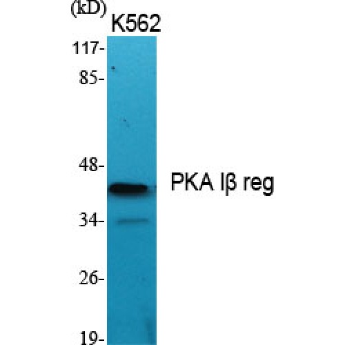 PRKAR1B Antibody - Western blot of PKA Ibeta reg antibody
