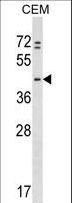 PRKAR1B Antibody - PRKAR1B Antibody western blot of CEM cell line lysates (35 ug/lane). The PRKAR1B antibody detected the PRKAR1B protein (arrow).