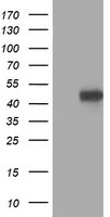 PRKAR1B Antibody - HEK293T cells were transfected with the pCMV6-ENTRY control (Left lane) or pCMV6-ENTRY PRKAR1B (Right lane) cDNA for 48 hrs and lysed. Equivalent amounts of cell lysates (5 ug per lane) were separated by SDS-PAGE and immunoblotted with anti-PRKAR1B.