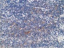 PRKAR1B Antibody - IHC of paraffin-embedded Human lymph node tissue using anti-PRKAR1B mouse monoclonal antibody.