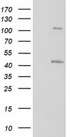 PRKAR1B Antibody - HEK293T cells were transfected with the pCMV6-ENTRY control (Left lane) or pCMV6-ENTRY PRKAR1B (Right lane) cDNA for 48 hrs and lysed. Equivalent amounts of cell lysates (5 ug per lane) were separated by SDS-PAGE and immunoblotted with anti-PRKAR1B.