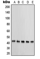 PRKAR1B Antibody - Western blot analysis of PRKAR1B expression in MCF7 (A); KNRK (B); NIH3T3 (C); HeLa (D); BT20 (E) whole cell lysates.