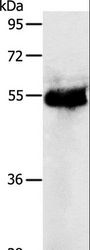 PRKAR1B Antibody - Western blot analysis of Human colon cancer tissue, using PRKAR1B Polyclonal Antibody at dilution of 1:1200.