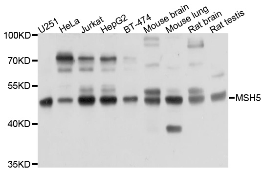 PRKAR1B Antibody - Western blot analysis of extracts of various cell lines, using PRKAR1B antibody at 1:1000 dilution. The secondary antibody used was an HRP Goat Anti-Rabbit IgG (H+L) at 1:10000 dilution. Lysates were loaded 25ug per lane and 3% nonfat dry milk in TBST was used for blocking. An ECL Kit was used for detection and the exposure time was 10s.