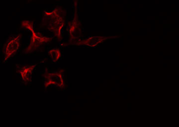 PRKAR1B Antibody - Staining COLO205 cells by IF/ICC. The samples were fixed with PFA and permeabilized in 0.1% Triton X-100, then blocked in 10% serum for 45 min at 25°C. The primary antibody was diluted at 1:200 and incubated with the sample for 1 hour at 37°C. An Alexa Fluor 594 conjugated goat anti-rabbit IgG (H+L) antibody, diluted at 1/600, was used as secondary antibody.