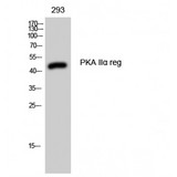 PRKAR2A Antibody - Western blot of PKA IIalpha reg antibody