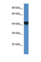 PRKAR2A Antibody - PRKAR2A antibody Western blot of Fetal Kidney lysate. Antibody concentration 1 ug/ml.  This image was taken for the unconjugated form of this product. Other forms have not been tested.