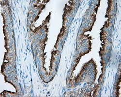 PRKAR2A Antibody - IHC of paraffin-embedded prostate tissue using anti-PRKAR2A mouse monoclonal antibody. (Dilution 1:50).