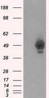 PRKAR2A Antibody - HEK293T cells were transfected with the pCMV6-ENTRY control (Left lane) or pCMV6-ENTRY PRKAR2A (Right lane) cDNA for 48 hrs and lysed. Equivalent amounts of cell lysates (5 ug per lane) were separated by SDS-PAGE and immunoblotted with anti-PRKAR2A.