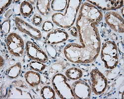 PRKAR2A Antibody - IHC of paraffin-embedded Kidney tissue using anti-PRKAR2A mouse monoclonal antibody. (Dilution 1:50).