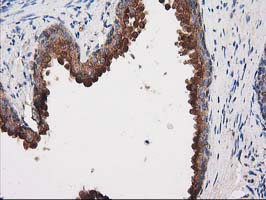 PRKAR2A Antibody - IHC of paraffin-embedded Human prostate tissue using anti-PRKAR2A mouse monoclonal antibody.