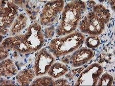 PRKAR2A Antibody - IHC of paraffin-embedded Human Kidney tissue using anti-PRKAR2A mouse monoclonal antibody.