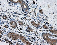 PRKAR2A Antibody - IHC of paraffin-embedded breast tissue using anti-PRKAR2A mouse monoclonal antibody. (Dilution 1:50).