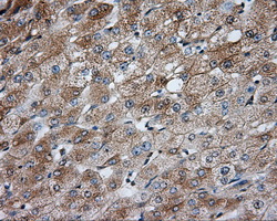 PRKAR2A Antibody - IHC of paraffin-embedded liver tissue using anti-PRKAR2A mouse monoclonal antibody. (Dilution 1:50).