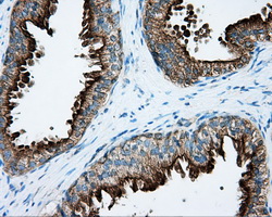 PRKAR2A Antibody - IHC of paraffin-embedded prostate tissue using anti-PRKAR2A mouse monoclonal antibody. (Dilution 1:50).
