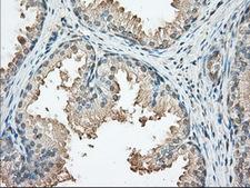 PRKAR2A Antibody - Immunohistochemical staining of paraffin-embedded Human prostate tissue using anti-PRKAR2A mouse monoclonal antibody. (Dilution 1:50).