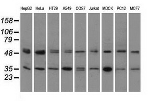 PRKAR2A Antibody - Western blot analysis of extracts (35ug) from 9 different cell lines by using anti-PRKAR2A monoclonal antibody.