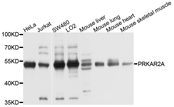 PRKAR2A Antibody - Western blot analysis of extracts of various cell lines, using PRKAR2A antibody at 1:1000 dilution. The secondary antibody used was an HRP Goat Anti-Rabbit IgG (H+L) at 1:10000 dilution. Lysates were loaded 25ug per lane and 3% nonfat dry milk in TBST was used for blocking. An ECL Kit was used for detection and the exposure time was 5s.