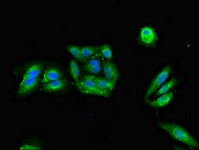PRKAR2A Antibody - Immunofluorescent analysis of HepG2 cells diluted at 1:100 and Alexa Fluor 488-congugated AffiniPure Goat Anti-Rabbit IgG(H+L)