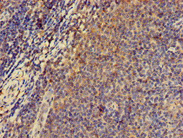 PRKAR2A Antibody - Immunohistochemistry of paraffin-embedded human lymph node tissue at dilution of 1:100