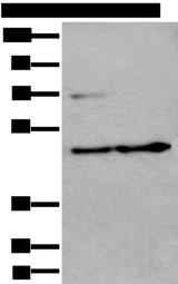 PRKAR2A Antibody - Western blot analysis of HEPG2 cell and Human testis tissue lysates  using PRKAR2A Polyclonal Antibody at dilution of 1:550