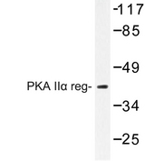 PRKAR2A Antibody - Western blot of PKA II reg (P68) pAb in extracts from 293 cells.