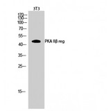 PRKAR2B Antibody - Western blot of PKA IIbeta reg antibody