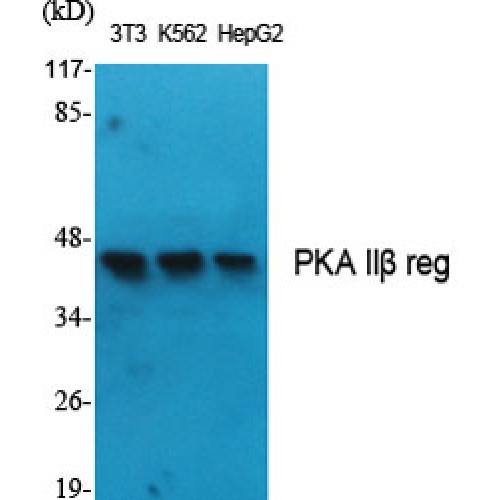 PRKAR2B Antibody - Western blot of PKA IIbeta reg antibody